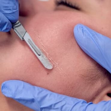 Dermaplane - 3 pack at Auraluminous Beauty in East Rutherford, NJ